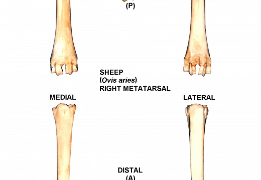 Right metatarsal