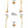 Right radius