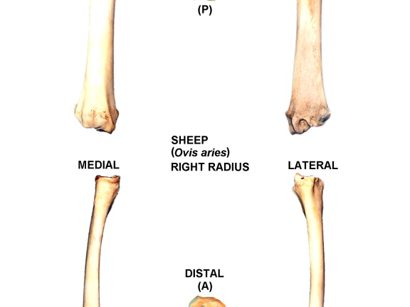 Right radius