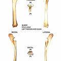 Radio y ulna izquierdos