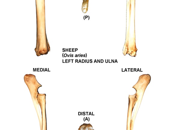 Left radius and ulna