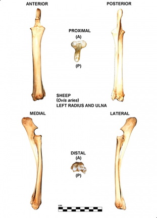 Radius et ulna gauches