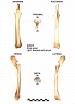 Radius et ulna gauches