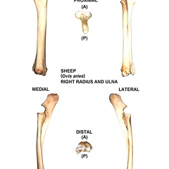 Right radius and ulna