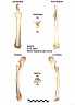 Radius et ulna droits
