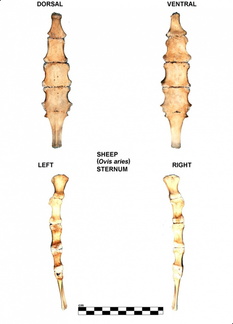 Sternum