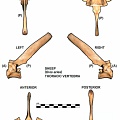 Thoracic vertebra