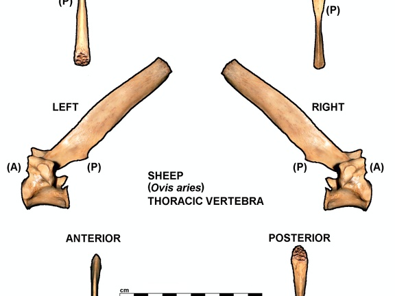 Thoracic vertebra