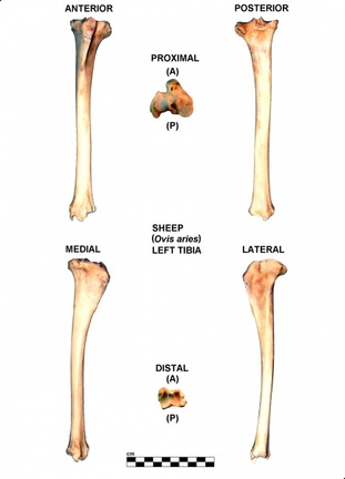 Tibia gauche