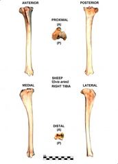 Tibia droit