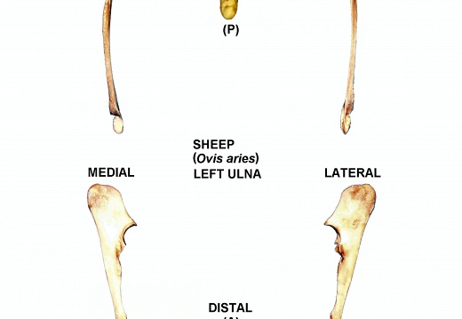 Left ulna