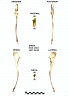 Ulna gauche