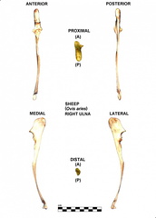 Ulna droite