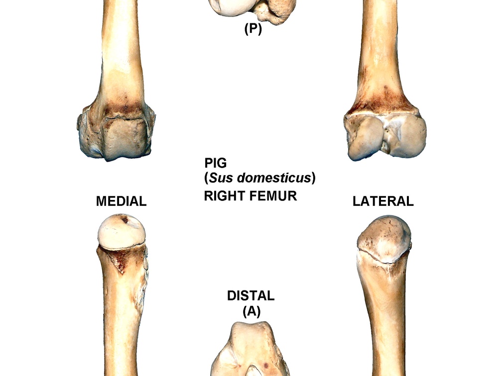 Right femur