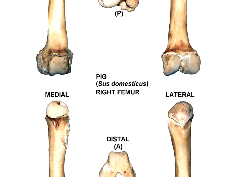 Fémur droit