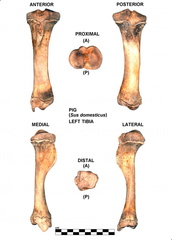 Tibia gauche