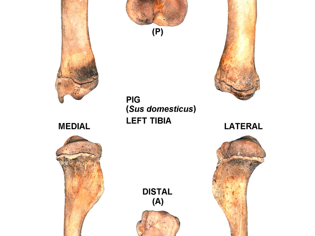 Tibia gauche