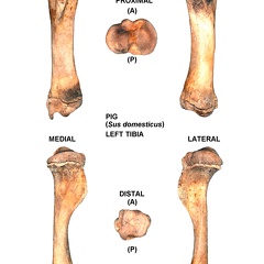 Tibia gauche