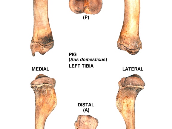 Left tibia