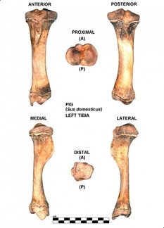 Tibia gauche