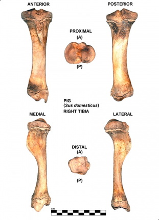 Right tibia