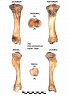 Tibia droit