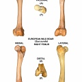 Fémur droit