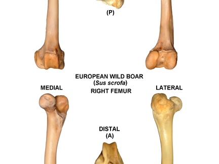 Right femur