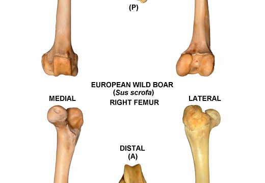 Right femur