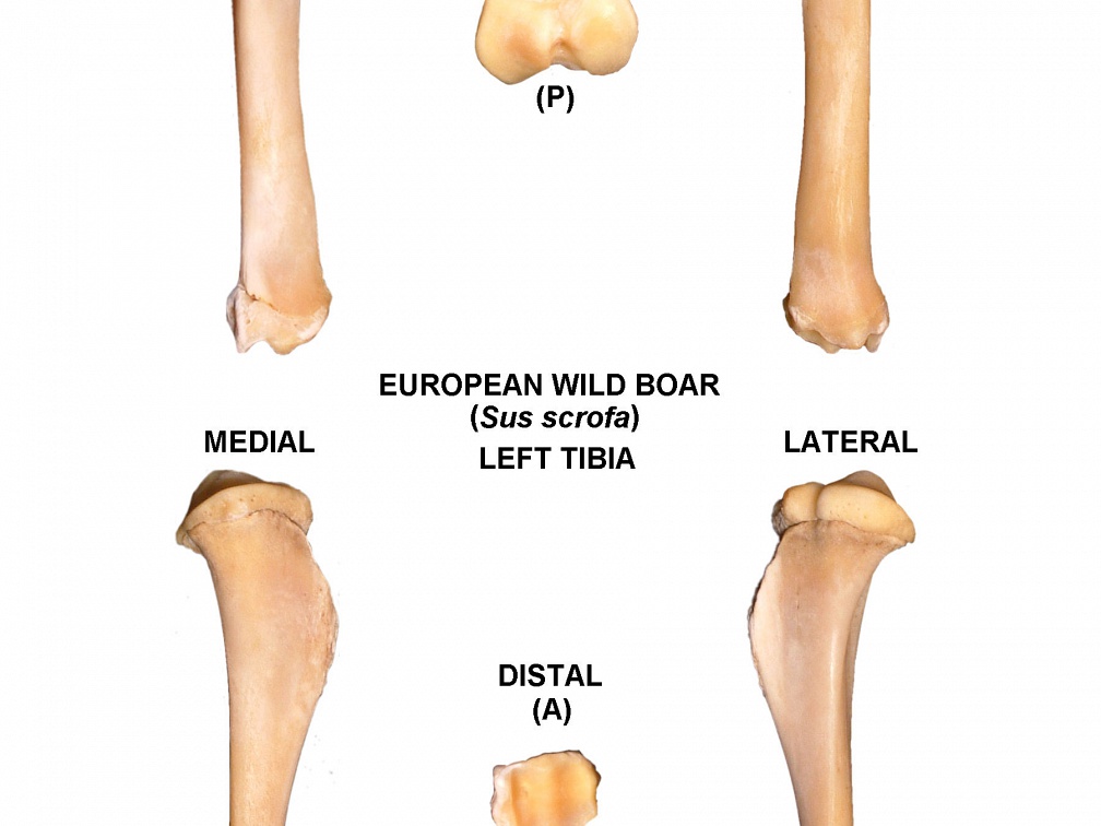 Tibia gauche