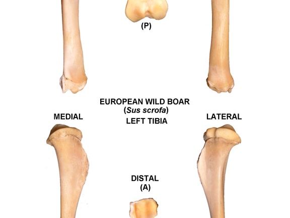 Left tibia