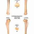 Tibia droit