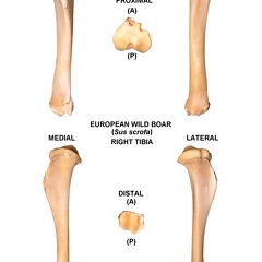 Tibia droit