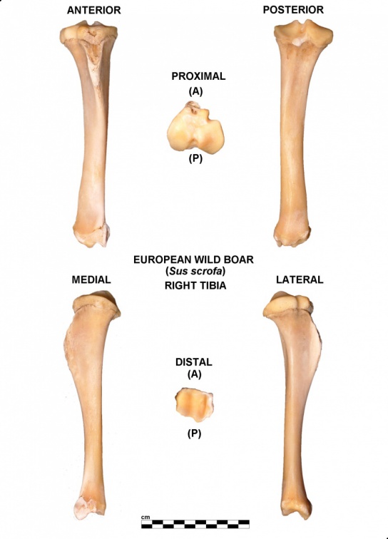 Tibia droit