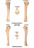 Tibia droit