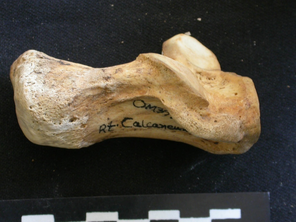 Calcaneus