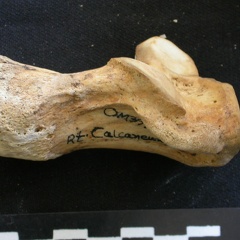 Calcaneus