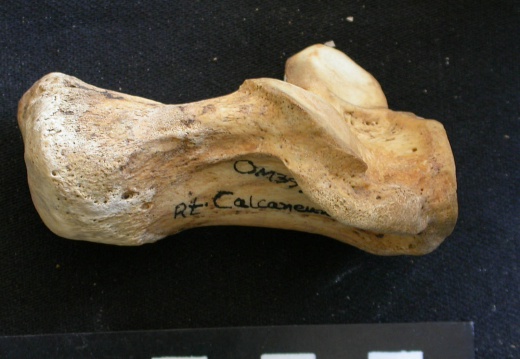 Calcaneus