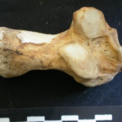 Calcaneus