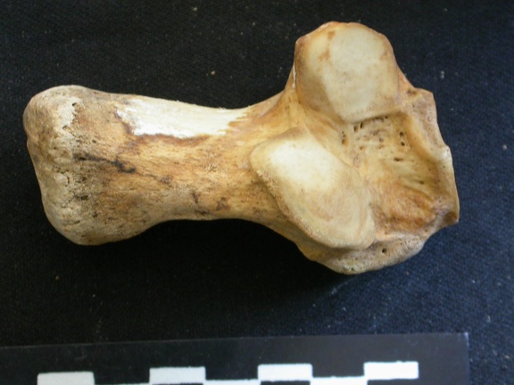 Calcaneus