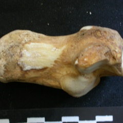 Calcaneus