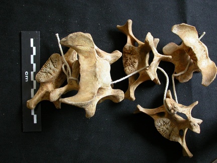 Cervical vertebrae