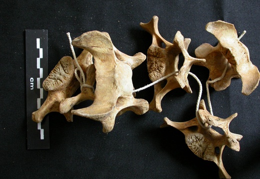 Cervical vertebrae