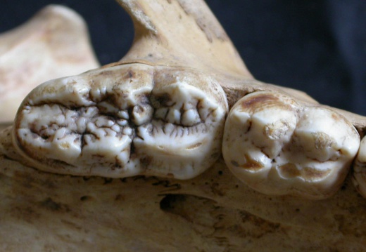 Dentition supérieure