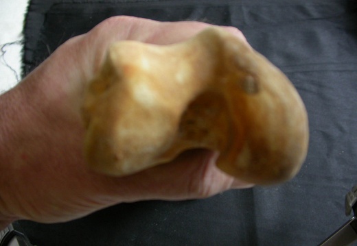 Femur: distal part