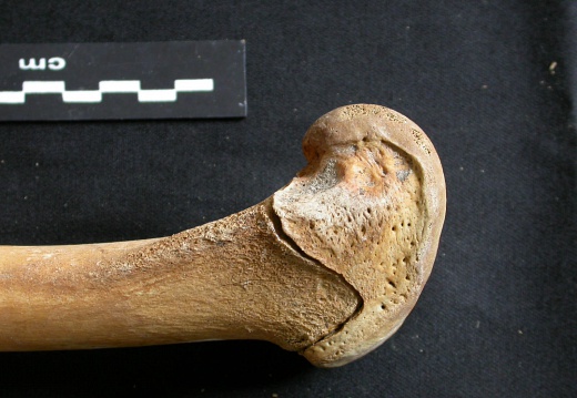 Femur: distal part