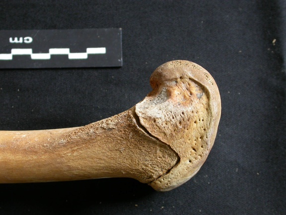 Fémur : partie distale (11007 visites) Ursus arctos - Femelle - Jeune adulte - Élément droitCollection : Département d'Ostéologie du Na... Fémur : partie distale