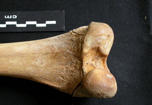 Femur: distal part