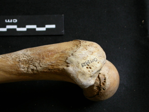 Fémur : parte proximal