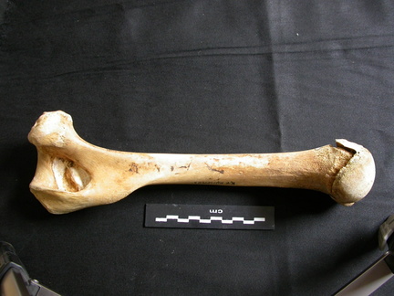 Humérus